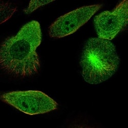 DCDC2 Antibody, Novus Biologicals 25 &mu;L, Unlabeled:Antibodies, Polyclonal